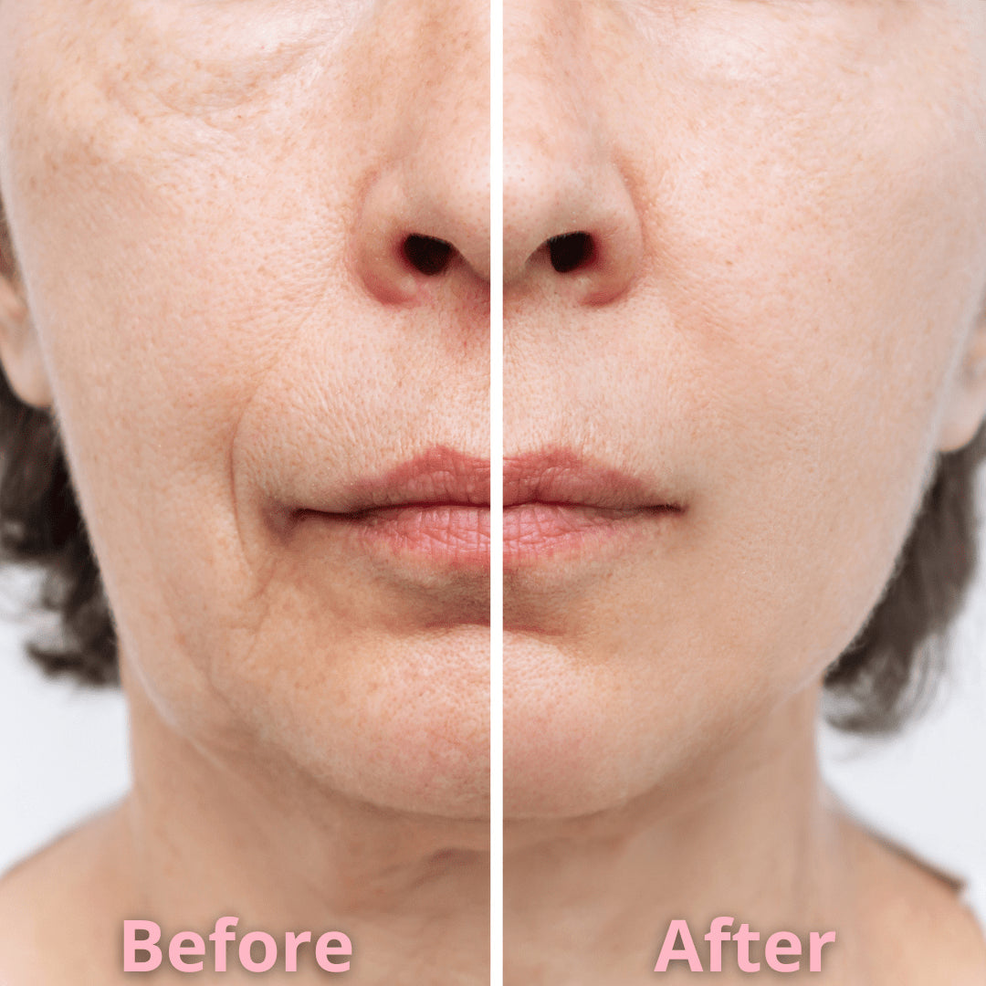 Lively® Cosmetics & Care Plumping Anti-Wrinkle Patches | Lively®