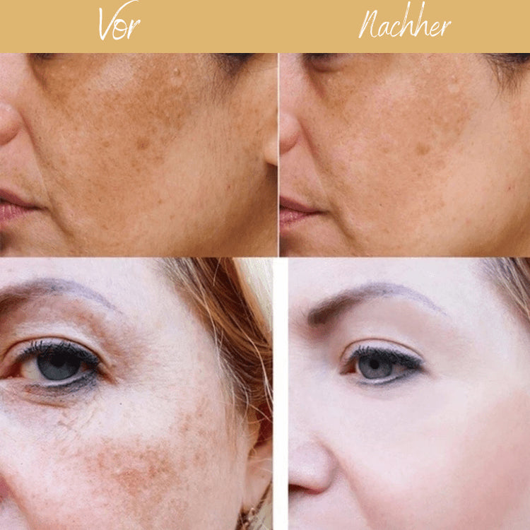 Lively® Cosmetics & Care Turmeric Serum for correcting dark spots | Lively®