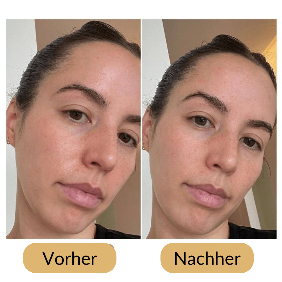 Lively® Cosmetics & Care Volcanic Roller for Matte Skin | Lively®