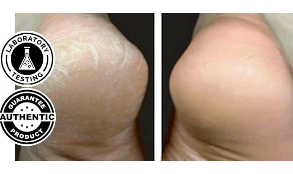 Lively® Cosmetics & Care White Electric Pedicure | Lively®